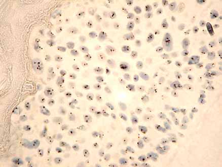 photo of tetrasomic nuclei